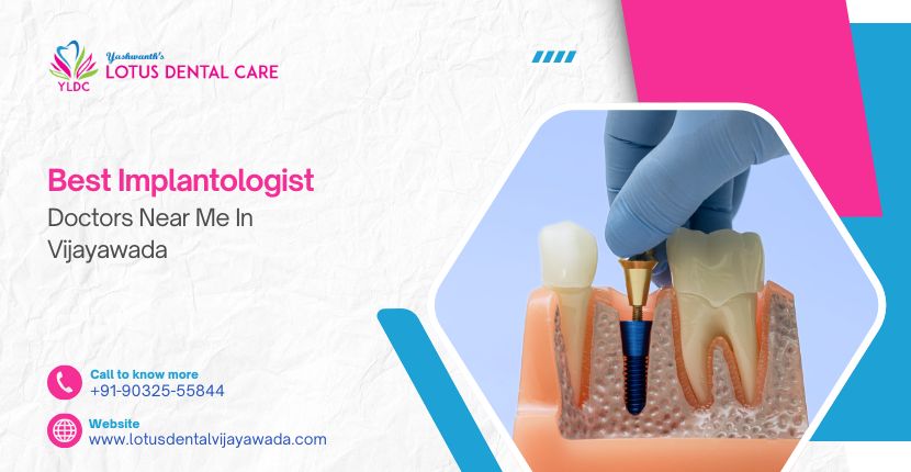 Best Implantologist Doctors Near Me in Vijayawada