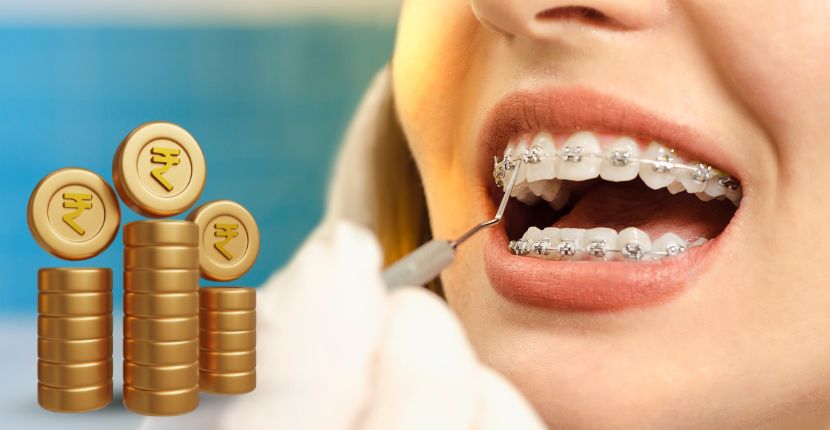 How to Plan for The Cost of Braces
