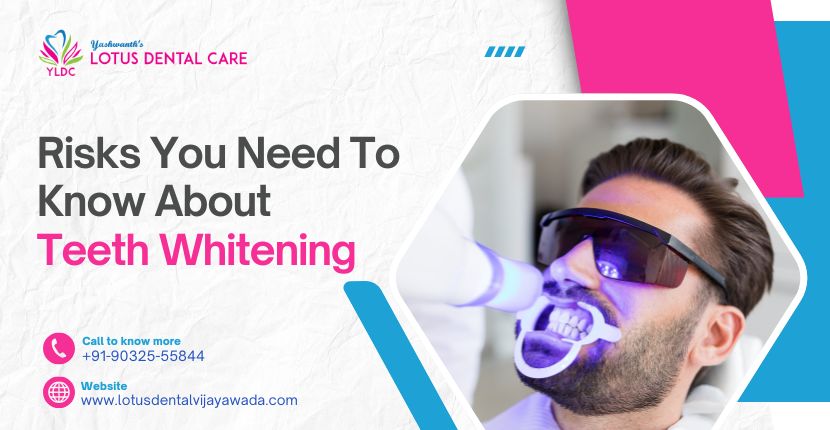 Risks You Need to Know About Teeth Whitening