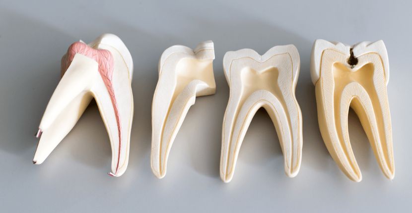 Root Canal Treatment The Best Way To Save A Tooth