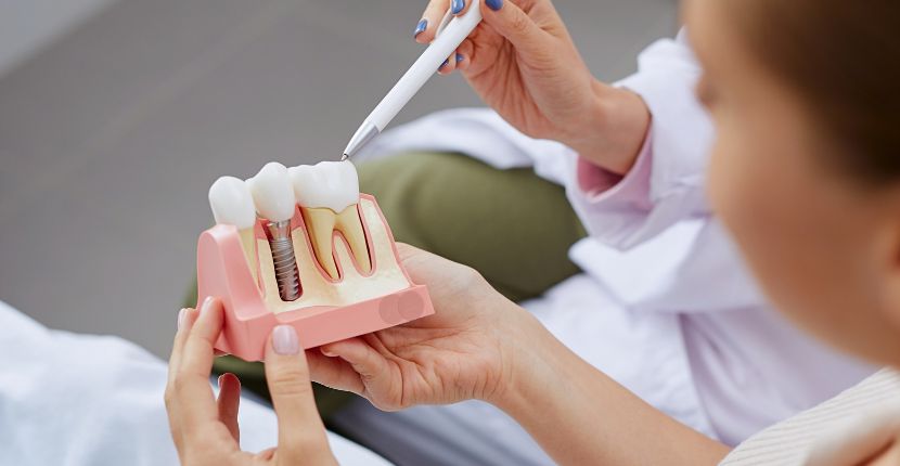 The Success Rate of Dental Implants Speaks for Itself
